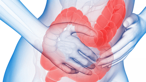 Sơ đồ mô tả cơ chế táo bón: nhu động ruột chậm, phân khô cứng và khó đi tiêu