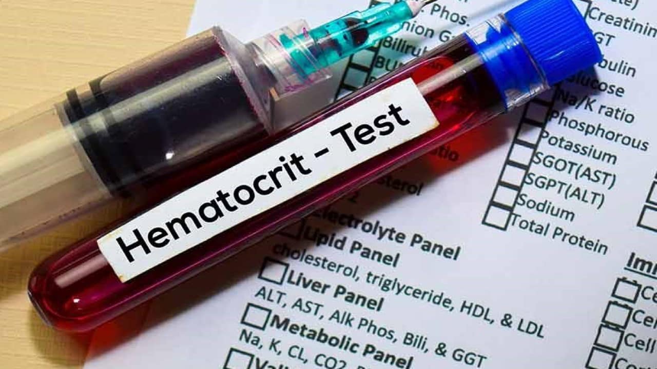 Đánh giá hematocrit cùng tốc độ giảm tiểu cầu giúp nhận biết nguy cơ thoát huyết tương