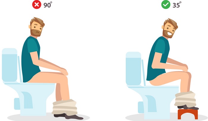 Đi vệ sinh đúng cách giúp giảm áp lực lên hậu môn và hạn chế nguy cơ trĩ quay lại sau điều trị