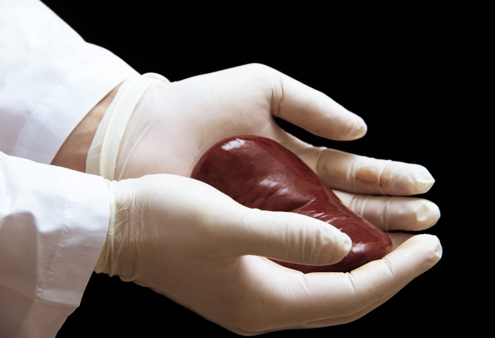 Bệnh nhân HIV được ghép thận và theo dõi điều trị