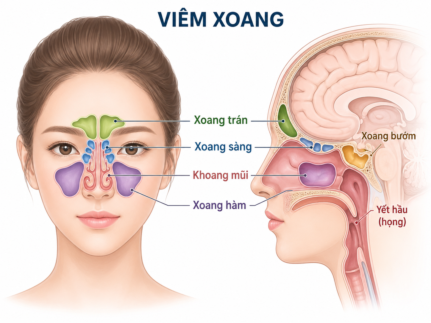 Phân biệt các loại viêm xoang giúp người bệnh nhận biết đúng nguyên nhân và mức độ bệnh