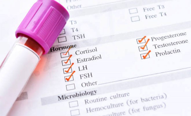 Một số xét nghiệm nội tiết như FSH, LH, Estradiol cần thực hiện vào ngày 2 đến 3 của chu kỳ kinh nguyệt